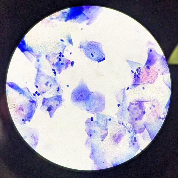 Ear swab matter from a animal under a microscope